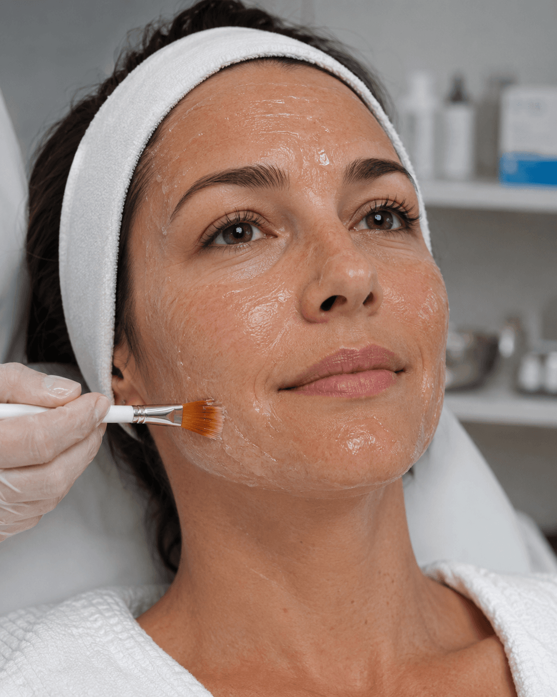 A woman mid-chemical-peel — the aggressive resurfacing intervention barrier-first methodology explicitly rejects. The peel disrupts the calcium gradient, collapses the lamellar structure, and asks a compromised barrier to accept damage in exchange for visible turnover.